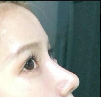 鼻孔大鼻翼薄(优美鼻型不仅要注重鼻，还要关注鼻翼)