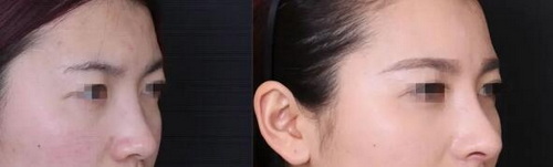 鼻子经常很油(如何解决经常很油的鼻子问题)