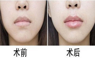 四医大口腔医院排名【医大口腔医院排名】