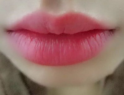 嘴角开裂怎样痊愈(嘴角边开裂怎样痊愈最快)