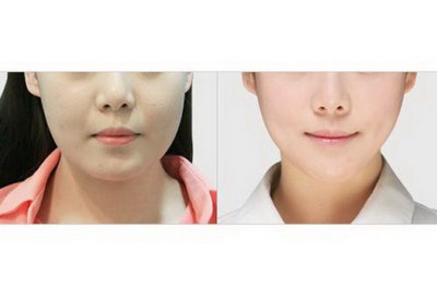北京好点的口腔医院最好[北京那家口腔医院最好]