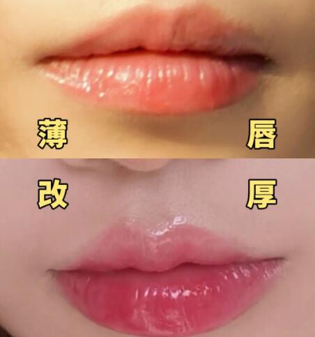 为什么舌头舔牙齿会出血(舔牙齿为何会导致出血？)
