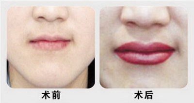 嘴唇小而厚怎么涂口红_嘴唇为什么有很多竖纹