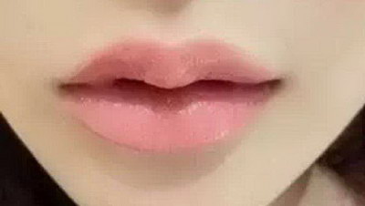 玻尿酸禁忌配伍和玻尿酸丰唇的费用大概是多少呢？
