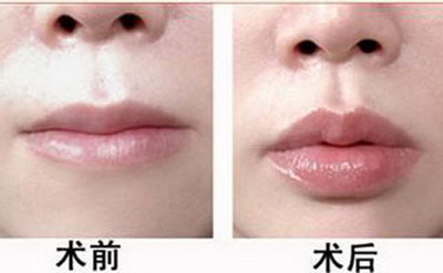 汉中口腔医院哪家好些(汉中口腔医院哪家好)
