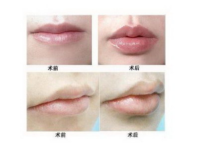 福州哪家看口腔比较好的医院(福州哪家医院看口腔比较好)