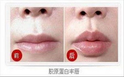 嘴唇发黑肝不好怎么调理