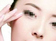 伊维兰填充法令纹效果的奇妙之处_哪家医院做自体填充法令纹最好