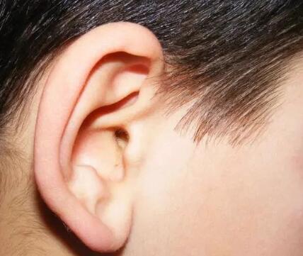 河南整形美容医院治耳畸形(河南省整形美容医院双眼皮)