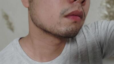 女生小胡子可以用物理脱毛吗(女生去除小胡子？可以使用物理脱毛吗？)