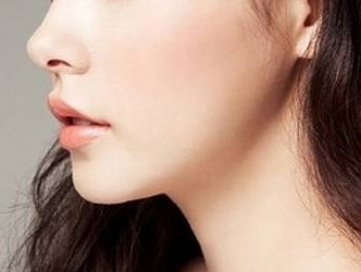 用激光点痣后几天会好(用激光点痣后几天会好)