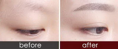 激光洗眉多久能长眉毛【激光洗眉多久可以化眉毛】