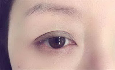 女人眉间有两道竖纹是什么相_女人眉间川字纹好不好
