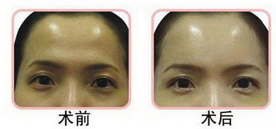 男人什么样的眉毛大富大贵_眉毛纹绣师赚钱吗
