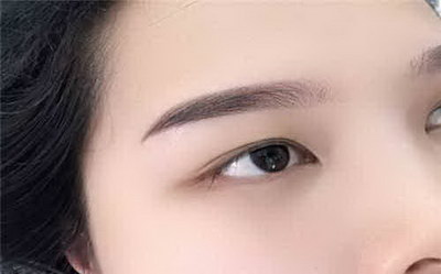 激光洗眉后涂什么修复