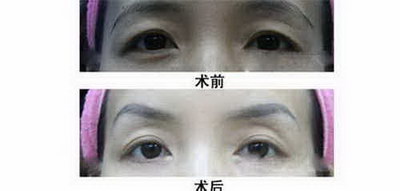 纹了眉毛多久可以敷面膜(眉毛做完多久可以敷面膜)