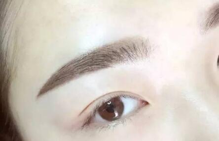 切眉好不好对眼部有不有影响_切眉提升手术管几年