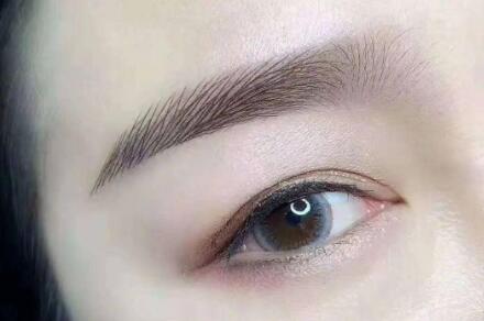做提眉术有什么后遗症吗(提眉术有没有什么后遗症)