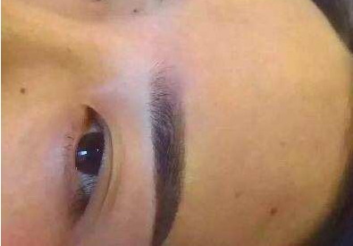 做眉位不正修复哪家好【做眉位不正修复哪家较好】
