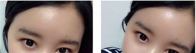 拉布拉多额头上有皱纹_怎么有效去除额头皱纹