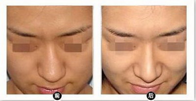 额头发黑是哪里出问题_女性额头发黑是五脏哪里的原因