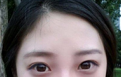 脸上皱纹怎么改善_脸上皱纹多怎么补