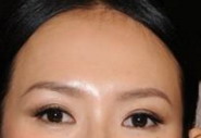 面部轮廓整形多久恢复(面部轮廓整形要多久恢复)