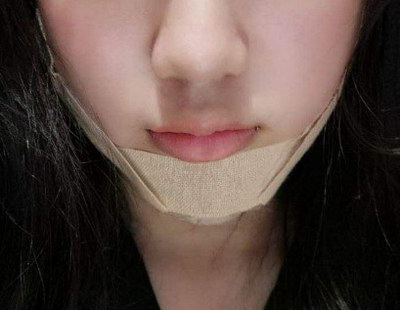 整牙能改变脸型吗(整牙会改变脸型)
