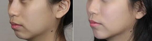 睡眠不好脸上长斑是什么原因引起的(睡眠不好脸上长斑是什么原因)