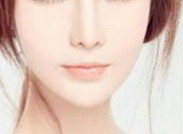 填充额头多久恢复(脂肪填充额头要多久恢复)