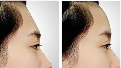 美容院脸部补水最好的方法(美容院脸部补水效果好吗)