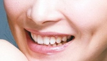 脸上皮肤有一块白怎么回事(脸上皮肤突然一块白是怎么回事)