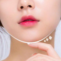 刚刚做完假体下巴可以用冰块敷吗