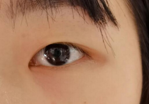 感觉脸部油腻怎么办_开塞露去除脸部皱纹吗