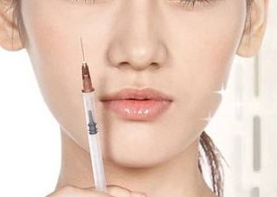 面部脂肪填充多久能看出存活了(面部脂肪填充的适用范围)