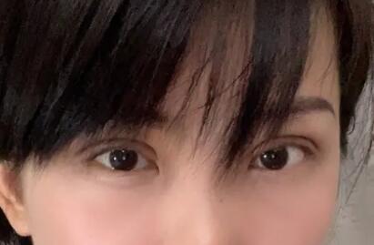 怎么让脸上的苹果肌变小_提拉苹果肌消除法令纹