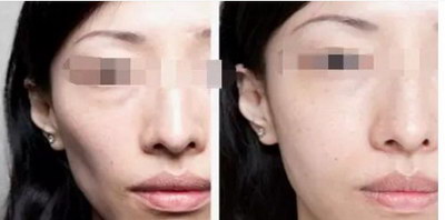 额头发黑是哪里出问题_女性额头发黑是五脏哪里的原因
