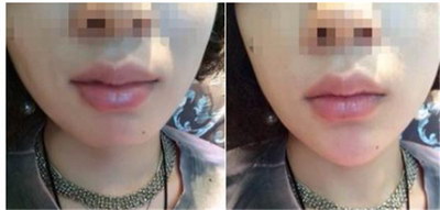 如何将方脸变成瓜子脸(如何把方脸变成瓜子脸)
