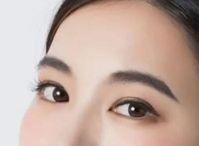 自体脂肪填胸要多久才能恢复(自体脂肪填胸要休息多久)
