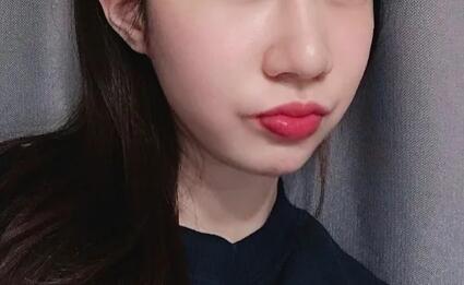 左右脸严重不对称_左脸法令纹比右脸深且长是怎么回事