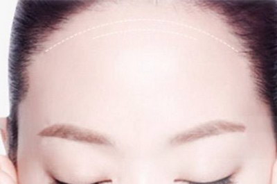 脸上长色斑是什么(人的脸上为什么长色斑)