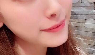 得了面部肌肉僵硬怎么办_打完除皱针面部浮肿该怎么办