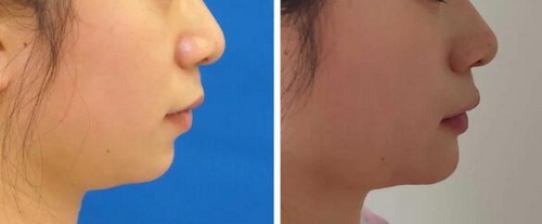 女脸上长斑是什么原因(更年期脸上长斑是因为什么原因引起的)