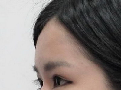 如何去脸上皱纹天涯_大宝眼角皱纹蜜真假