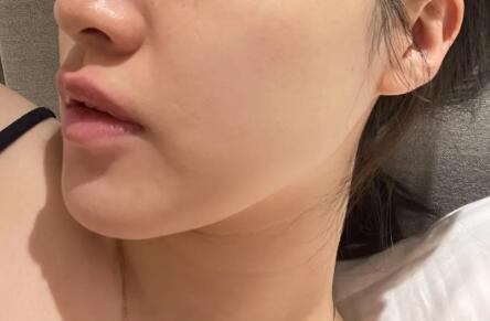 如何判断自己是敏感肌肤(如何判断自己是不是敏感肌)