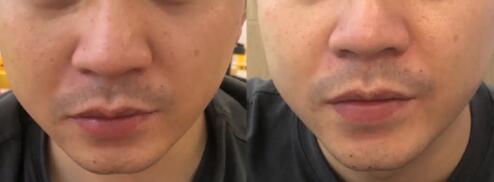 怎么使自己的皮肤变白_怎样让脸皮肤变紧致