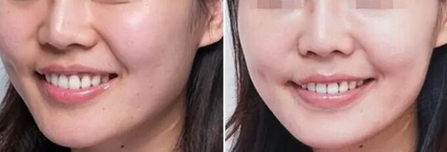 成都那些医院皮肤科可以看痘痘