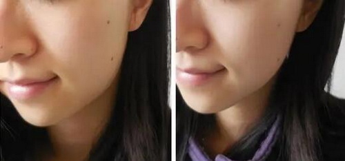 额上长痘痘是什么原因