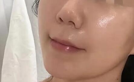 有脂肪颗粒怎么去掉(什么是脂肪颗粒？)