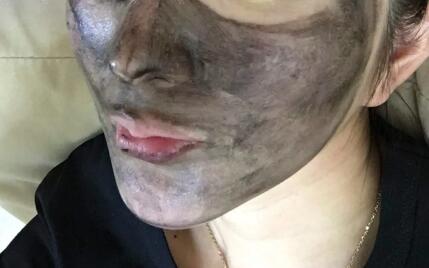 美容院洗脸能让皮肤变好吗_皮肤松了怎样变紧致